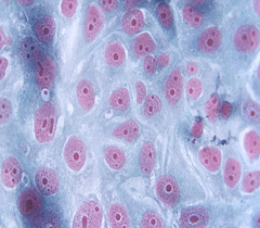 細(xì)胞侵襲、轉(zhuǎn)染